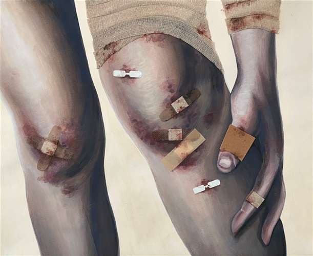 Image of Healing Wounds artwork.